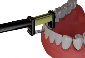 Strisce di finura per lucidatura diamantata per sega dentale Strisce di finura per lucidatura diamantata per sega dentale