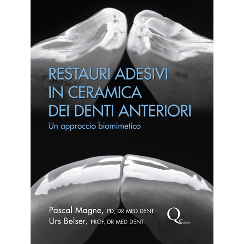 Restauri adesivi in ceramica dei denti anteriori - Pascal Magne Urs Belser