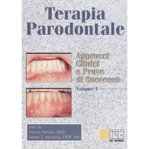 TERAPIA PARODONTALE - M Nevins, J Mellonig - ISBN 88-86927-04-5