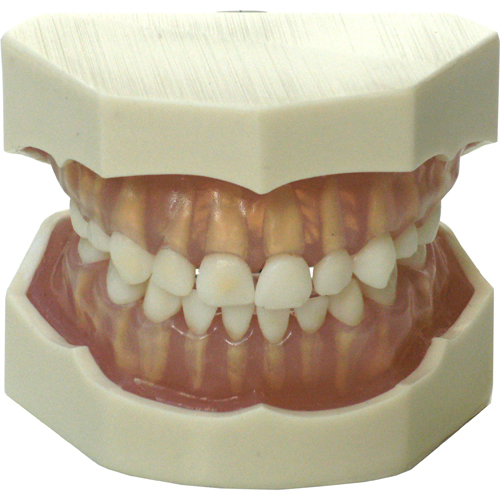 Modello dentizione decidua