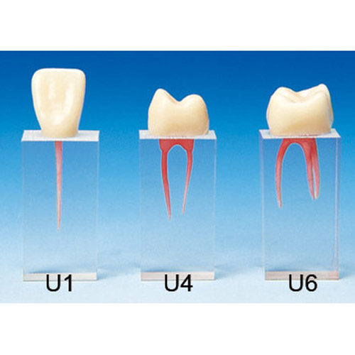 Blocchetti Esercitazioni Endodontiche - Simulatori - NISSIN Set 3 U1-4-6