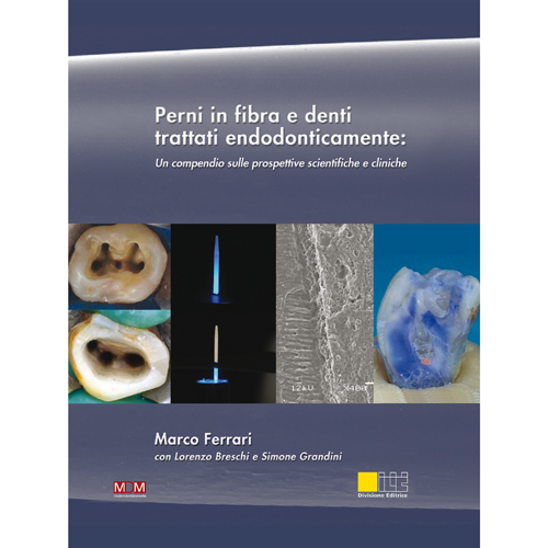 PERNI IN FIBRA E DENTI TRATTATI ENDODONTICAMENTE - Marco Ferrari con Lorenzo Breschi e Simone Grandini - ISBN 978-88-86927-08-6