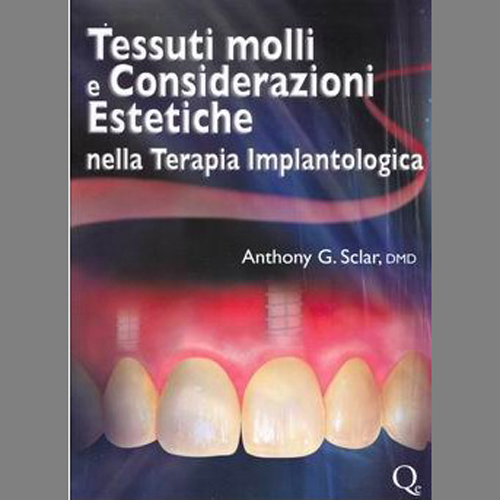 Tessuti molli e considerazioni estetiche nella terapia implantologica - Anthony G. Sclar