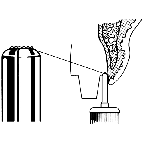 Diamantata TPE Taglio in testa protetto lateralmente 1,4 mm grana Grossa CORTA 1 pz.